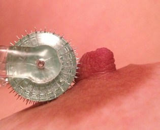 close up of pin wheel on nipple