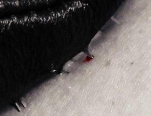 Droplet of blood on skin from Vampire glove spike