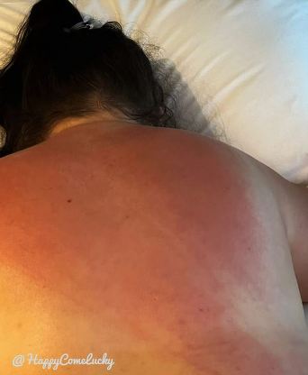 Honey's back red from a flogging