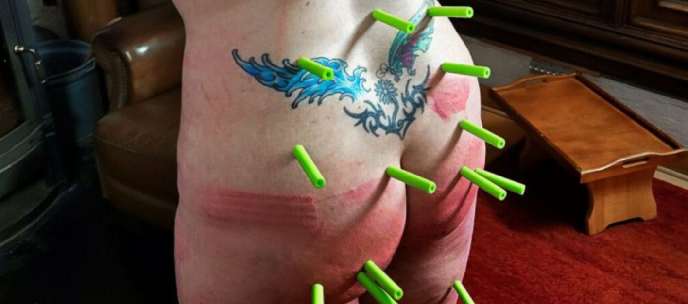 Cropped image showing bare botton with nerf gun bullets and whip marks